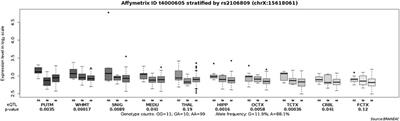 Evaluation of a Functional Single Nucleotide Polymorphism of the SARS-CoV-2 Receptor ACE2 That Is Potentially Involved in Long COVID